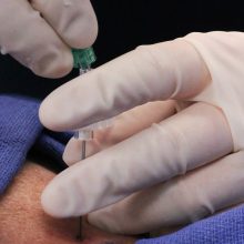 BLOQUEIOS PARA A DOR