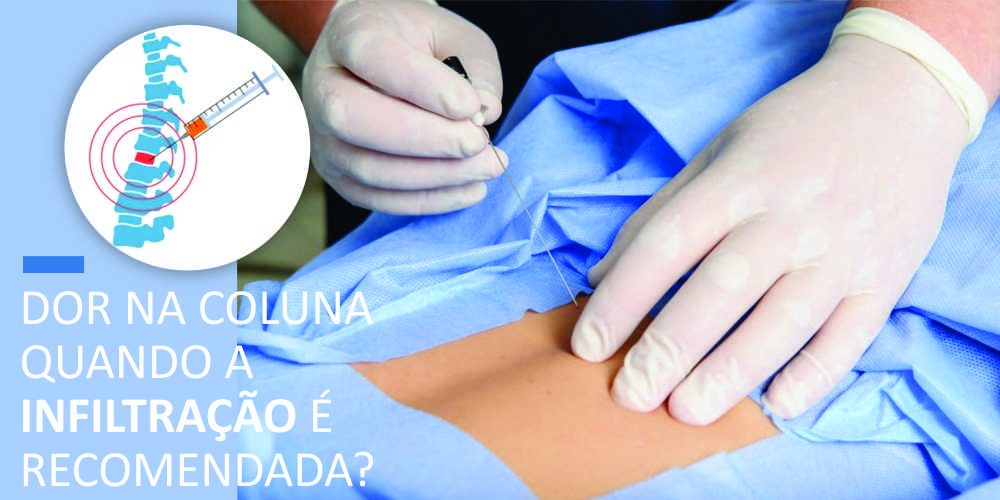 DOR NA COLUNA | QUANDO A INFILTRAÇÃO É RECOMENDADA?