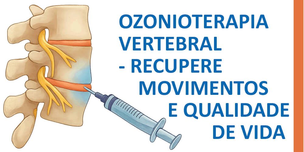 OZONIOTERAPIA VERTEBRAL | RECUPERE MOVIMENTOS E QUALIDADE DE VIDA