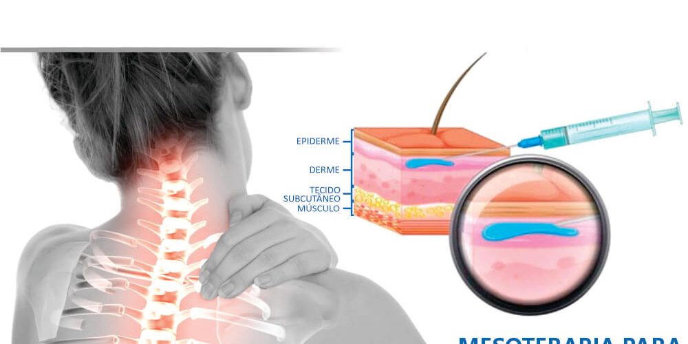 MESOTERAPIA PARA DORES NA COLUNA SOLUÇÃO MINIMAMENTE INVASIVA QUE DEVOLVE MOVIMENTO